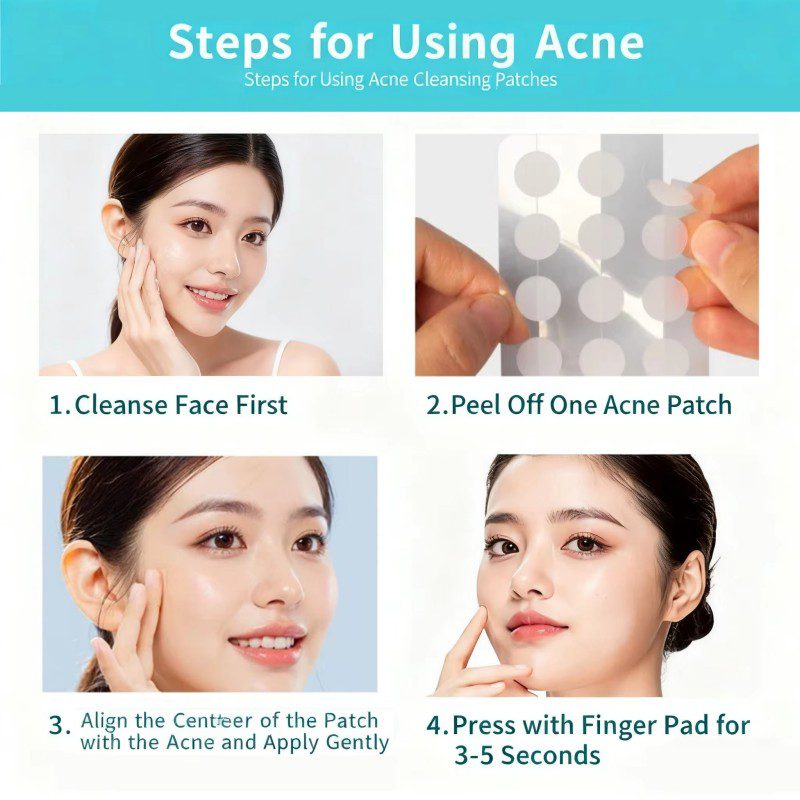 pressed cutting edge pimple patch wholesale (3)