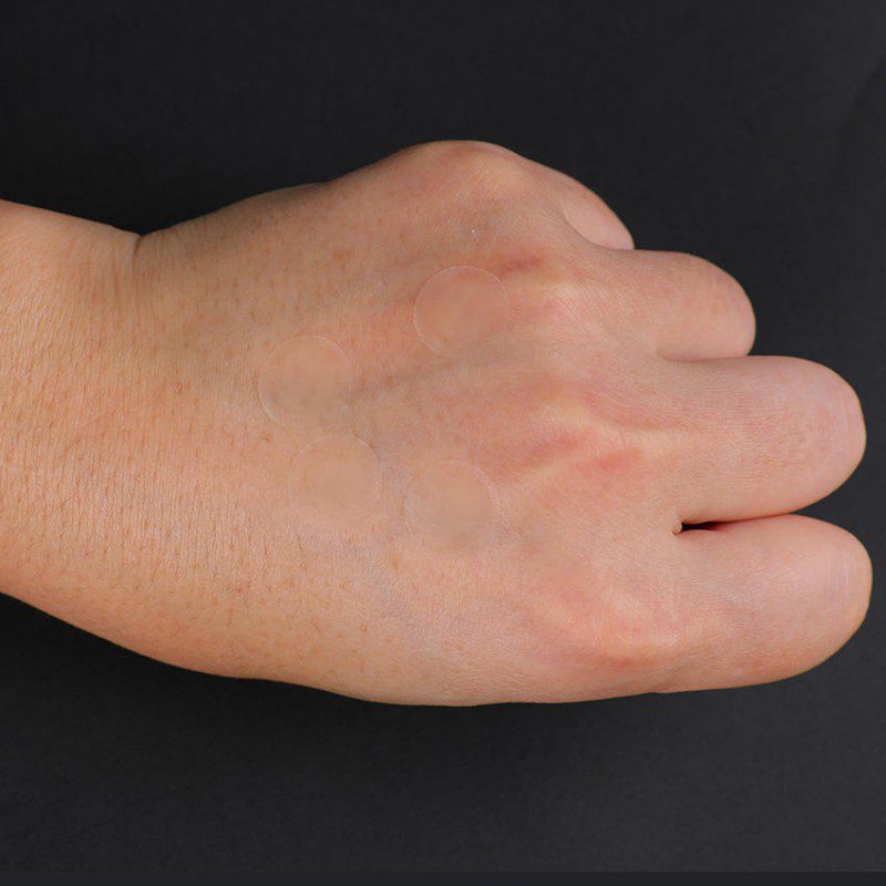 pressed cutting edge pimple patch wholesale (5)